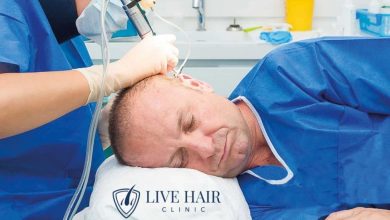 Saç ekimi, İstanbul saç ekimi, Saç ekimi fiyatları